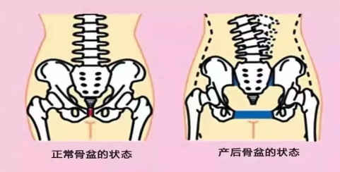 产后怎么康复治疗【产后康复】“手法+气压”骨盆修复，唤醒女性自然之美_https://www.jmylbn.com_新闻资讯_第2张