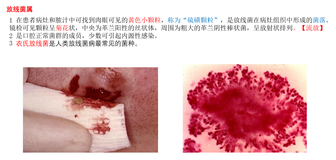 放线杆菌怎么治疗