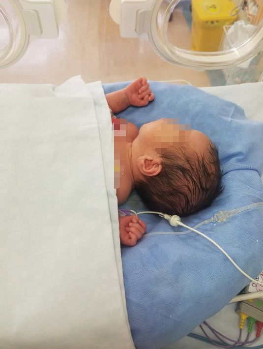 孕婦遭車禍昏迷49天，寶寶頑強生長順利出生！「媽媽，請醒來看我一眼」 親子 第11張
