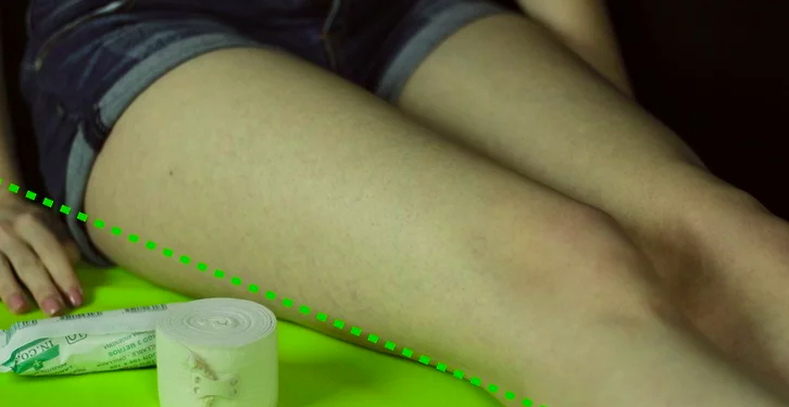 医用绷带怎么绑图解如何用绷带绑膝盖？运动时膝关节疼很有用！_https://www.jmylbn.com_新闻资讯_第2张