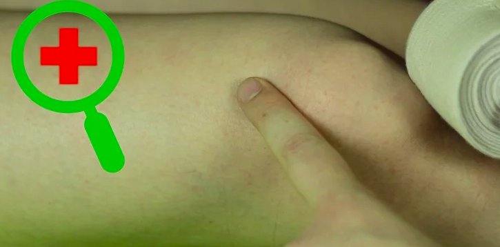 医用绷带怎么绑图解如何用绷带绑膝盖？运动时膝关节疼很有用！_https://www.jmylbn.com_新闻资讯_第9张