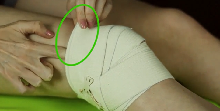 医用绷带怎么绑图解如何用绷带绑膝盖？运动时膝关节疼很有用！_https://www.jmylbn.com_新闻资讯_第5张