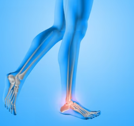 步态分析上曲线怎么解读「走路」是什么？ 物理治疗师教你如何分析人类的步态！_https://www.jmylbn.com_新闻资讯_第1张