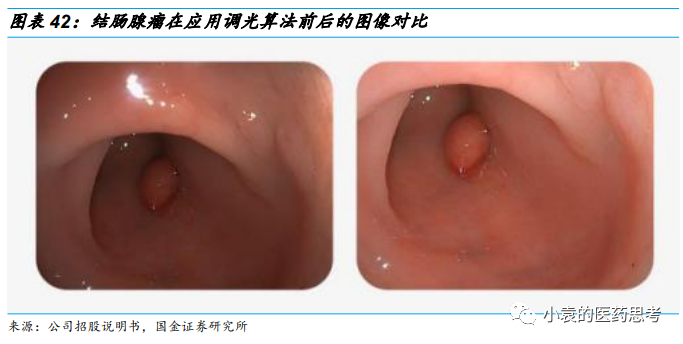 国产胃镜都有什么品牌【国金医疗·深度】澳华内镜：国产软镜领域开拓者，进口替代驱动产品增长_https://www.jmylbn.com_新闻资讯_第37张