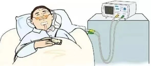 什么是有创呼吸机图片【健康科普】ICU救命神器“呼吸机”，你了解多少呢？_https://www.jmylbn.com_新闻资讯_第2张