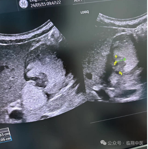 logiq e怎么读【功能科-科普篇】-彩色多普勒超声诊断仪GE LOGIQ E11_https://www.jmylbn.com_新闻资讯_第5张