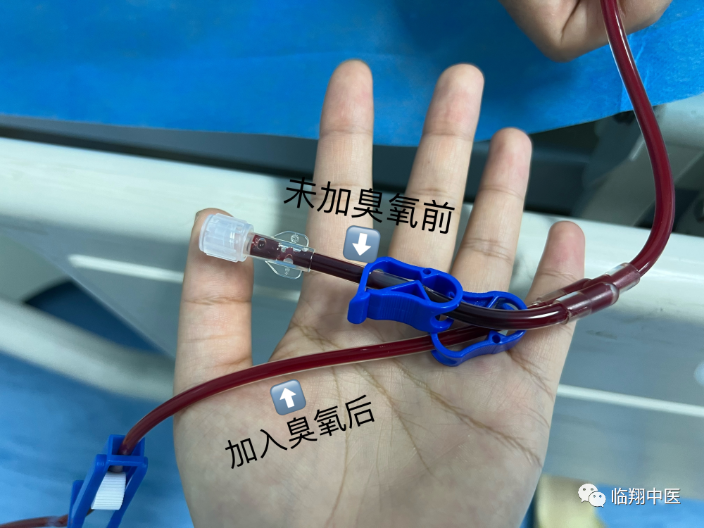 什么是臭氧大自血疗法（特色治疗）三氧大自血疗法_https://www.jmylbn.com_新闻资讯_第4张