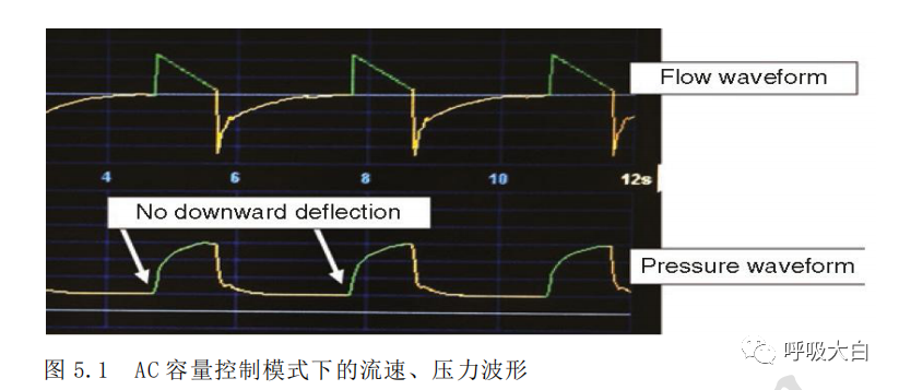 呼吸机pip是什么意思机械通气基础4-有创机械通气的模式_https://www.jmylbn.com_新闻资讯_第1张