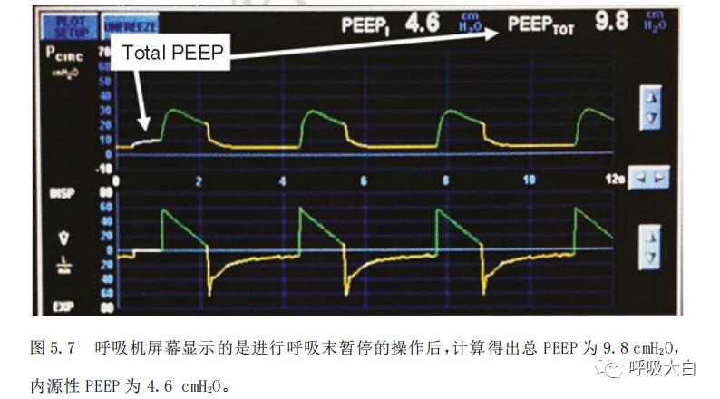 呼吸机pip是什么意思机械通气基础4-有创机械通气的模式_https://www.jmylbn.com_新闻资讯_第6张