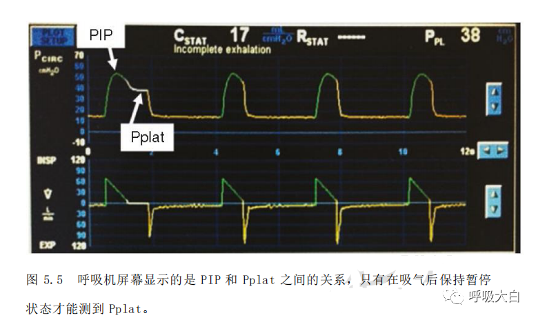 呼吸机pip是什么意思机械通气基础4-有创机械通气的模式_https://www.jmylbn.com_新闻资讯_第4张