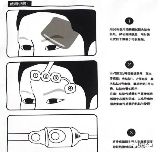 医疗bis是什么脑电双频指数 （BIS）-上海聚慕医疗器械有限公司