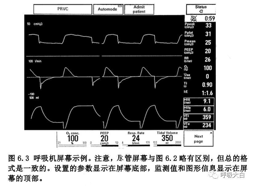 呼吸机怎么看机械通气基础5-认识呼吸机屏幕_https://www.jmylbn.com_新闻资讯_第3张