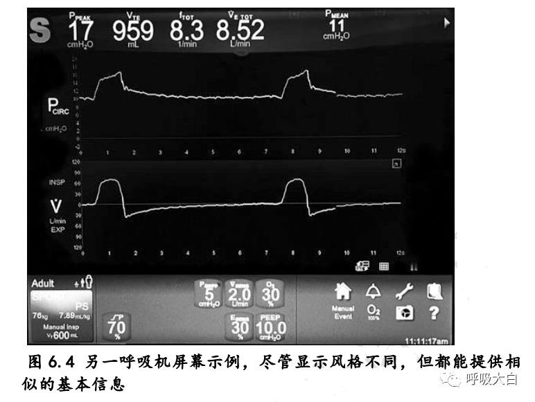 呼吸机怎么看机械通气基础5-认识呼吸机屏幕_https://www.jmylbn.com_新闻资讯_第4张