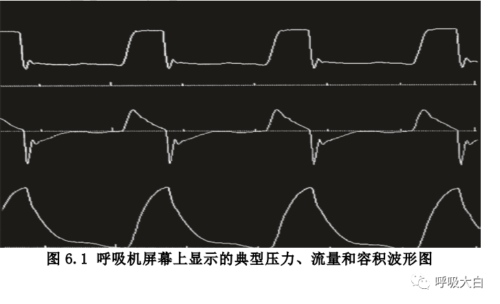 呼吸机怎么看机械通气基础5-认识呼吸机屏幕_https://www.jmylbn.com_新闻资讯_第1张
