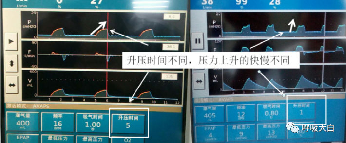 呼吸机压力怎么设置10无创呼吸机的次要参数+无创呼吸机的报警设置与错误触发_https://www.jmylbn.com_新闻资讯_第1张