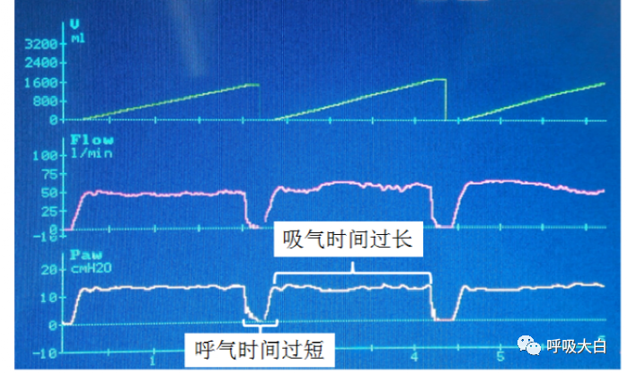 呼吸机呼气阀是什么11、家用无创呼吸机的特点_https://www.jmylbn.com_新闻资讯_第4张
