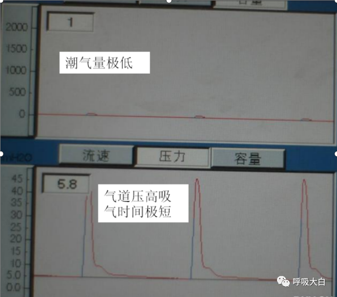 呼吸机呼吸怎么写学会呼吸机（呼吸机波形、通气模式、呼吸机设置、呼吸机报警、无创呼吸机、家用呼吸机）_https://www.jmylbn.com_新闻资讯_第15张