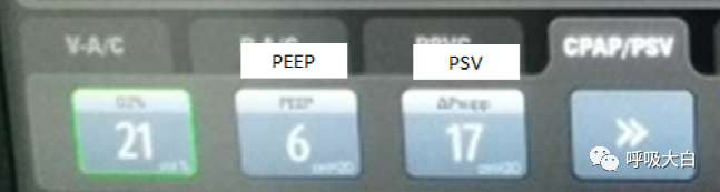 无创呼吸机怎么呼吸9常用无创呼吸机通气模式介绍+智能无创通气模式—AVAPS_https://www.jmylbn.com_新闻资讯_第1张