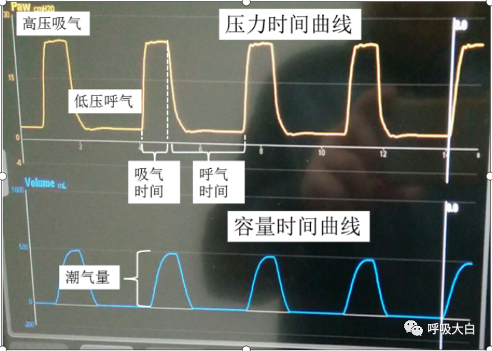呼吸机呼吸怎么写学会呼吸机（呼吸机波形、通气模式、呼吸机设置、呼吸机报警、无创呼吸机、家用呼吸机）_https://www.jmylbn.com_新闻资讯_第5张