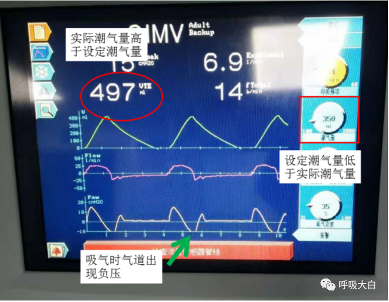 呼吸机呼吸怎么写学会呼吸机（呼吸机波形、通气模式、呼吸机设置、呼吸机报警、无创呼吸机、家用呼吸机）_https://www.jmylbn.com_新闻资讯_第16张