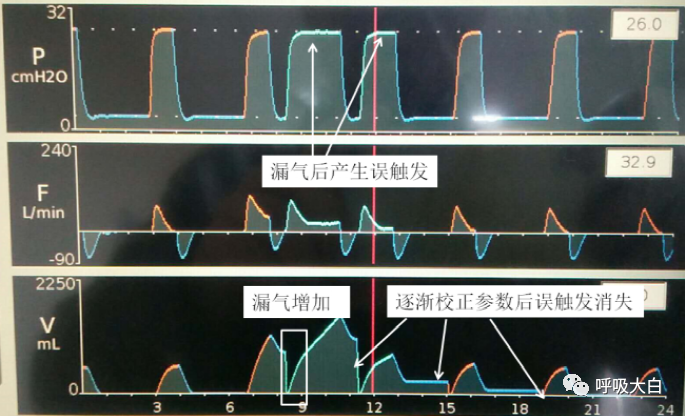 呼吸机呼气阀是什么11、家用无创呼吸机的特点_https://www.jmylbn.com_新闻资讯_第2张