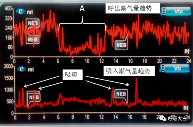 呼吸机呼吸怎么写学会呼吸机（呼吸机波形、通气模式、呼吸机设置、呼吸机报警、无创呼吸机、家用呼吸机）_https://www.jmylbn.com_新闻资讯_第8张
