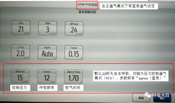 呼吸机压力怎么设置6呼吸机报警的设置+胸外心脏按压时的呼吸机设置_https://www.jmylbn.com_新闻资讯_第1张