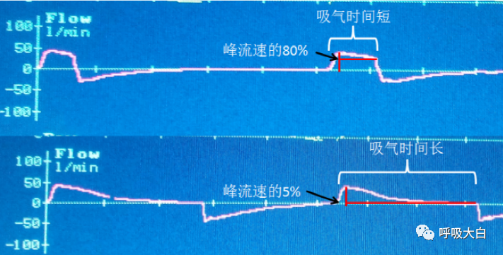 呼吸机压力怎么设置5、呼吸机的次要设置参数_https://www.jmylbn.com_新闻资讯_第2张