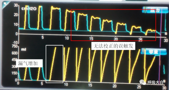 呼吸机呼气阀是什么11、家用无创呼吸机的特点_https://www.jmylbn.com_新闻资讯_第3张