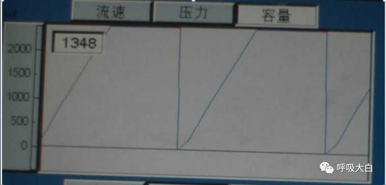 呼吸机呼吸怎么写学会呼吸机（呼吸机波形、通气模式、呼吸机设置、呼吸机报警、无创呼吸机、家用呼吸机）_https://www.jmylbn.com_新闻资讯_第12张