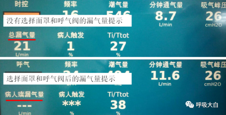 呼吸机压力怎么设置10无创呼吸机的次要参数+无创呼吸机的报警设置与错误触发_https://www.jmylbn.com_新闻资讯_第9张