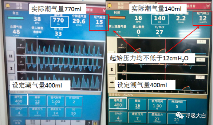无创呼吸机怎么呼吸9常用无创呼吸机通气模式介绍+智能无创通气模式—AVAPS_https://www.jmylbn.com_新闻资讯_第12张