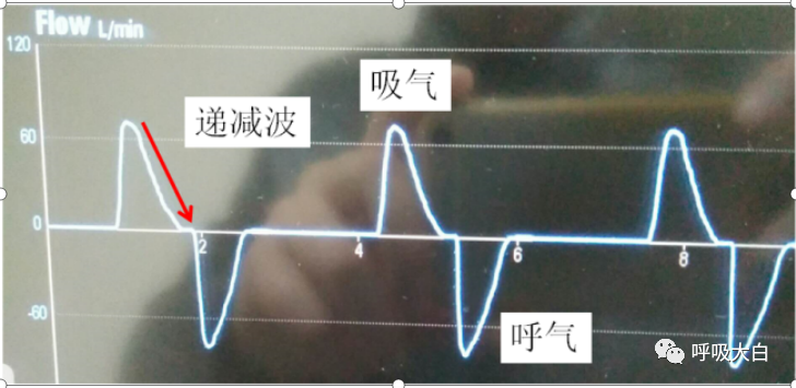 呼吸机呼吸怎么写学会呼吸机（呼吸机波形、通气模式、呼吸机设置、呼吸机报警、无创呼吸机、家用呼吸机）_https://www.jmylbn.com_新闻资讯_第6张