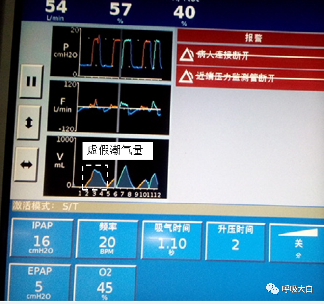 呼吸机压力怎么设置10无创呼吸机的次要参数+无创呼吸机的报警设置与错误触发_https://www.jmylbn.com_新闻资讯_第11张