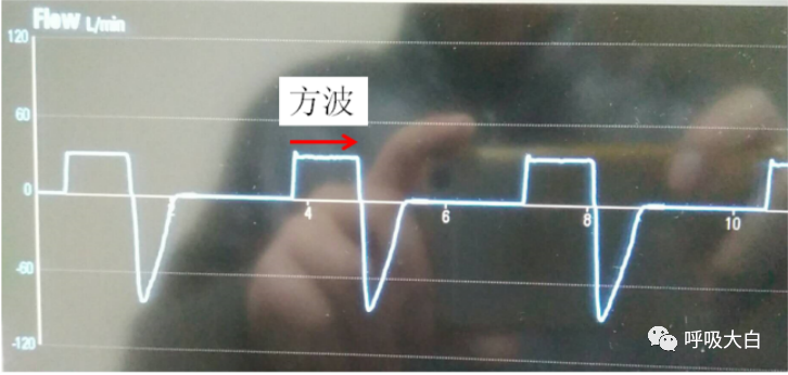 呼吸机呼吸怎么写学会呼吸机（呼吸机波形、通气模式、呼吸机设置、呼吸机报警、无创呼吸机、家用呼吸机）_https://www.jmylbn.com_新闻资讯_第7张