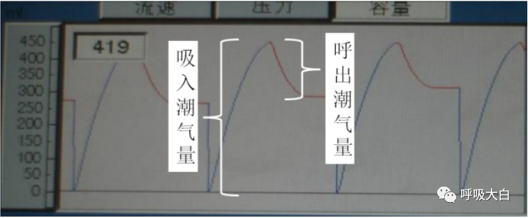 呼吸机呼吸怎么写学会呼吸机（呼吸机波形、通气模式、呼吸机设置、呼吸机报警、无创呼吸机、家用呼吸机）_https://www.jmylbn.com_新闻资讯_第11张