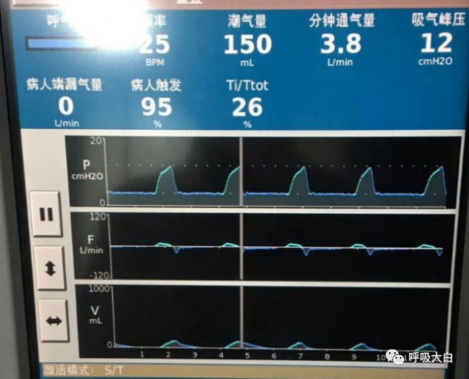 呼吸机的怎么调节全面了解无创通气模式和参数的设置_https://www.jmylbn.com_新闻资讯_第3张