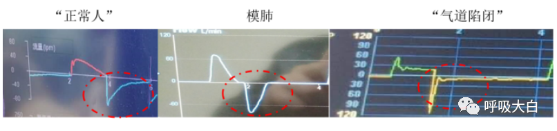 呼吸机呼吸怎么写学会呼吸机（呼吸机波形、通气模式、呼吸机设置、呼吸机报警、无创呼吸机、家用呼吸机）_https://www.jmylbn.com_新闻资讯_第17张