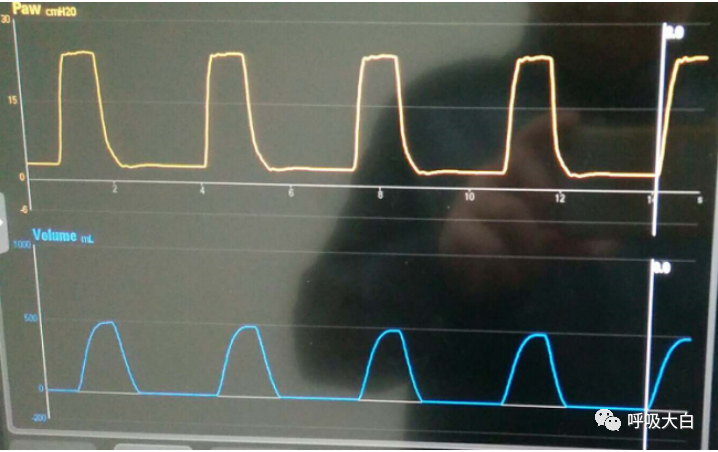 呼吸机呼吸怎么写学会呼吸机（呼吸机波形、通气模式、呼吸机设置、呼吸机报警、无创呼吸机、家用呼吸机）_https://www.jmylbn.com_新闻资讯_第10张