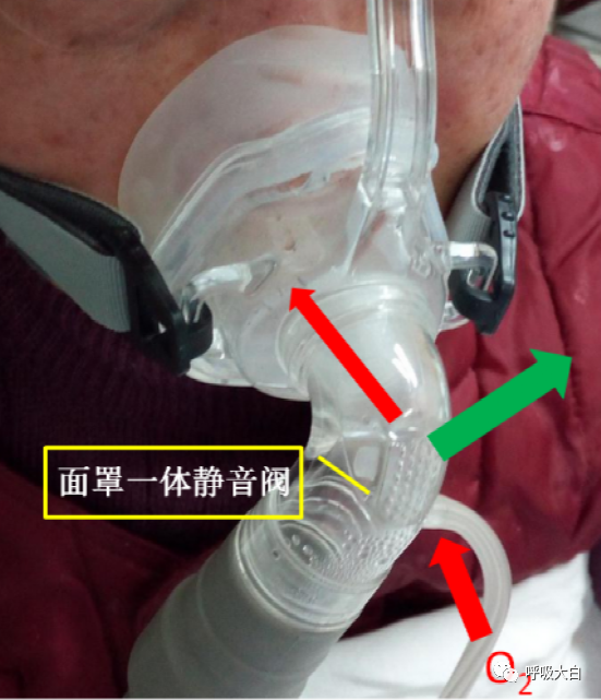 呼吸机呼气阀是什么11、家用无创呼吸机的特点_https://www.jmylbn.com_新闻资讯_第1张