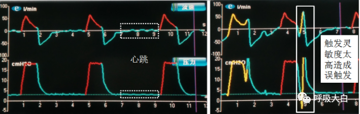 呼吸机压力怎么设置5、呼吸机的次要设置参数_https://www.jmylbn.com_新闻资讯_第4张