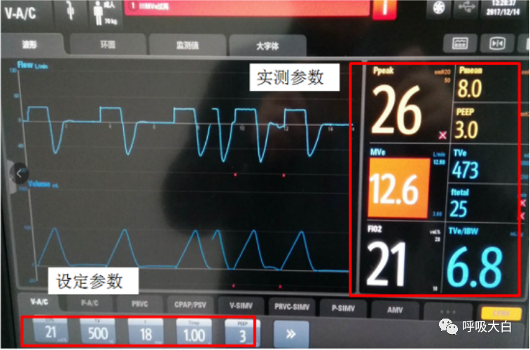呼吸机呼吸怎么写学会呼吸机（呼吸机波形、通气模式、呼吸机设置、呼吸机报警、无创呼吸机、家用呼吸机）_https://www.jmylbn.com_新闻资讯_第9张
