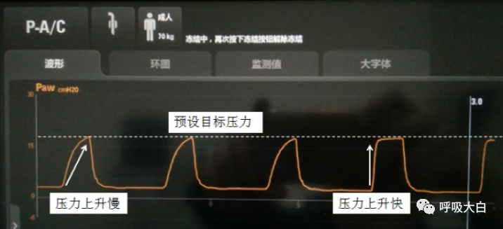 呼吸机压力怎么设置5、呼吸机的次要设置参数_https://www.jmylbn.com_新闻资讯_第1张
