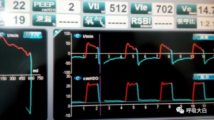 呼吸机压力怎么设置5、呼吸机的次要设置参数_https://www.jmylbn.com_新闻资讯_第7张