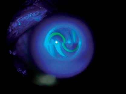 眼压计怎么用Goldmann眼压计（二）：使用方法、注意事项、误差来源_https://www.jmylbn.com_新闻资讯_第12张