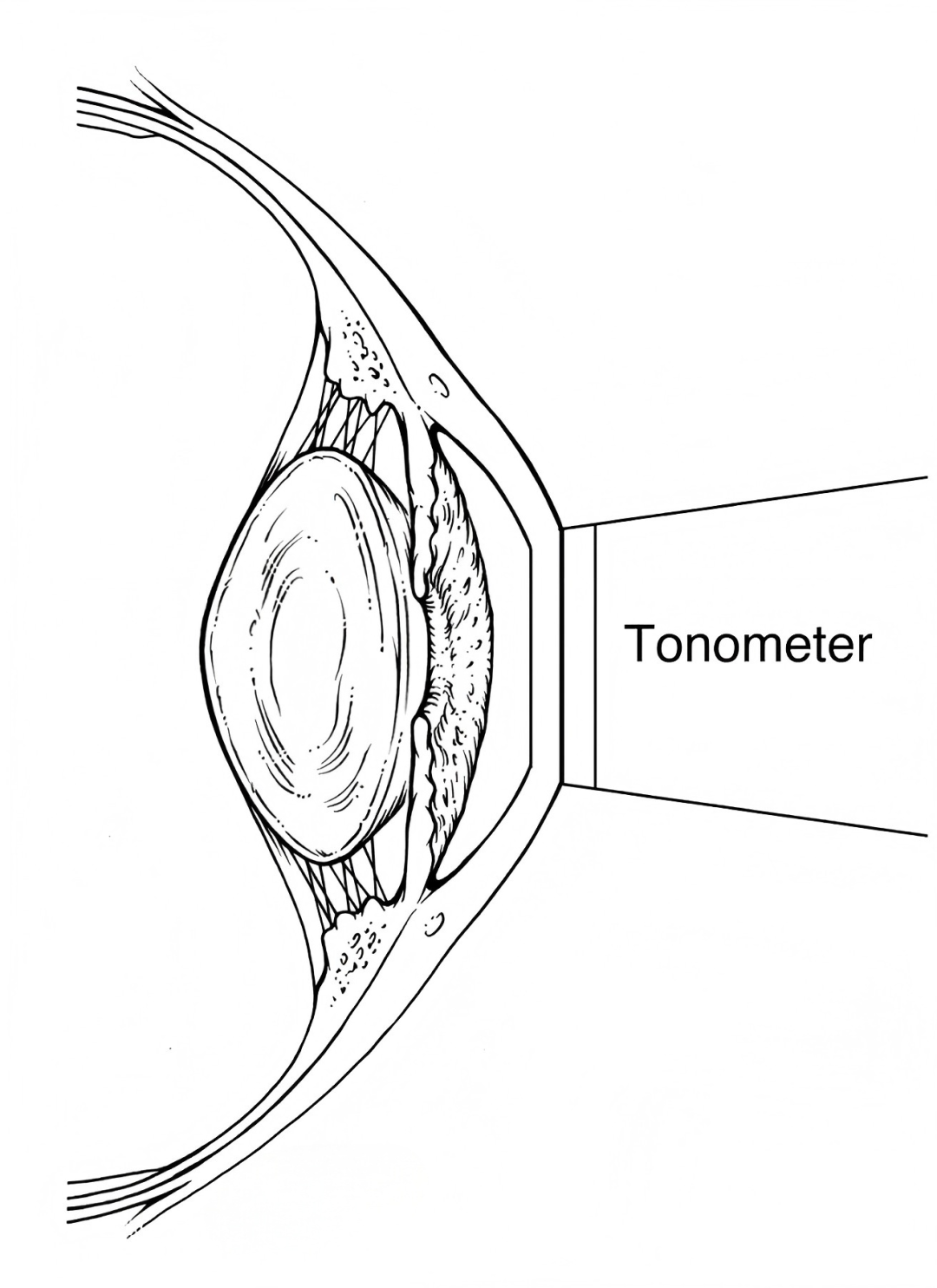 眼压计怎么用Goldmann眼压计（二）：使用方法、注意事项、误差来源_https://www.jmylbn.com_新闻资讯_第9张