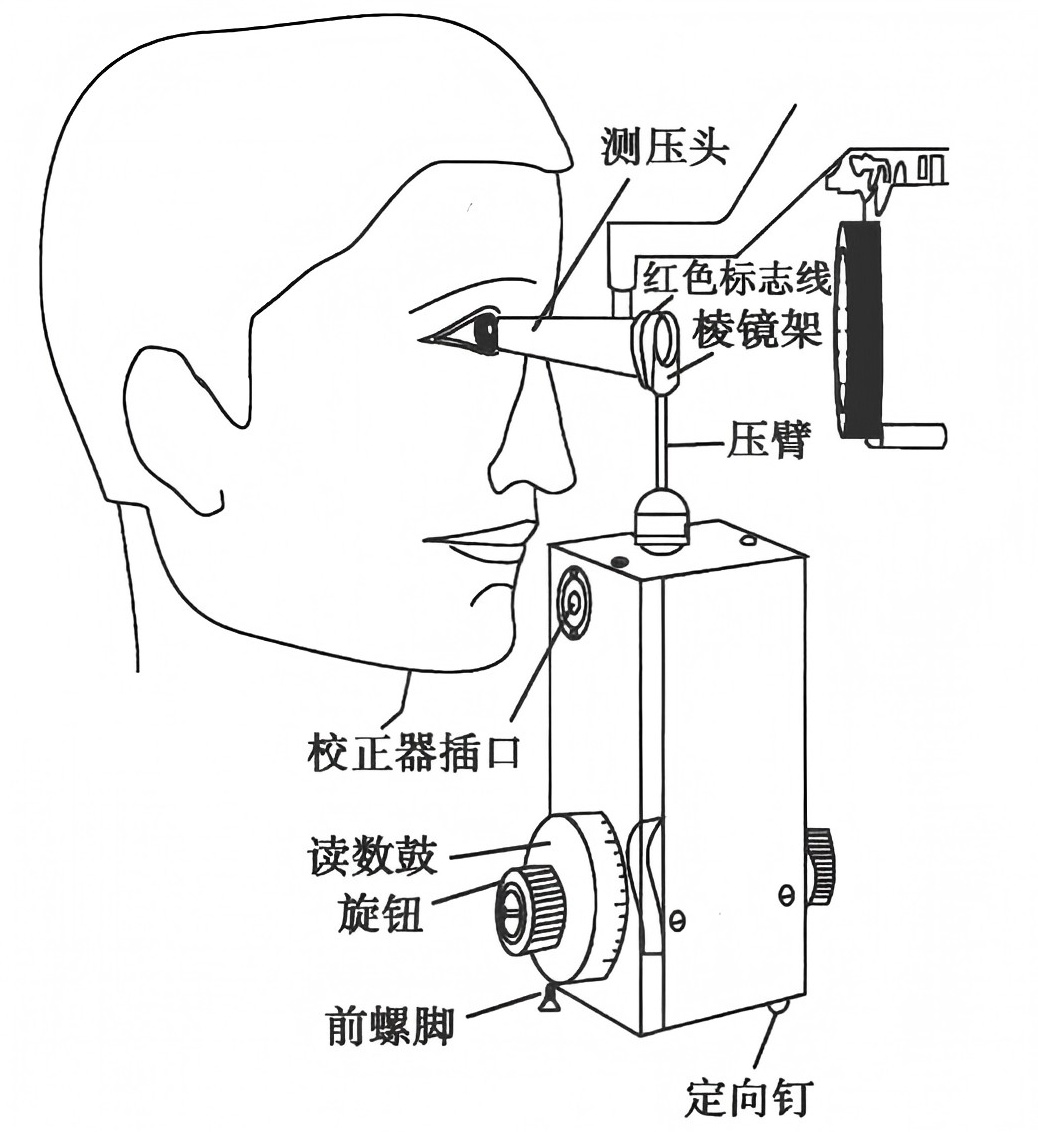 眼压计怎么用Goldmann眼压计（二）：使用方法、注意事项、误差来源_https://www.jmylbn.com_新闻资讯_第8张