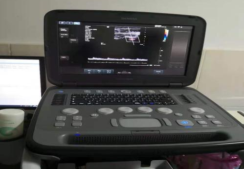 胎儿超声心电图是什么【优势学科】医学影像二科_https://www.jmylbn.com_新闻资讯_第7张