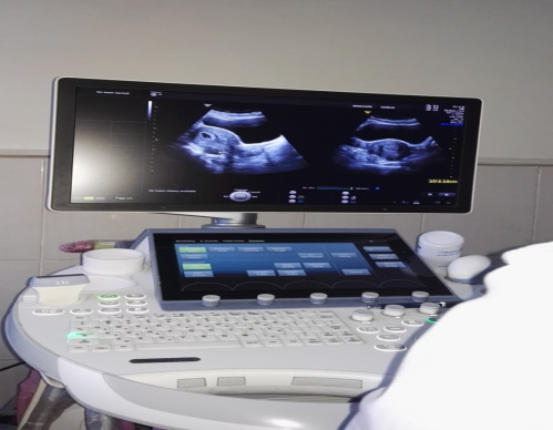 胎儿超声心电图是什么【优势学科】医学影像二科_https://www.jmylbn.com_新闻资讯_第4张