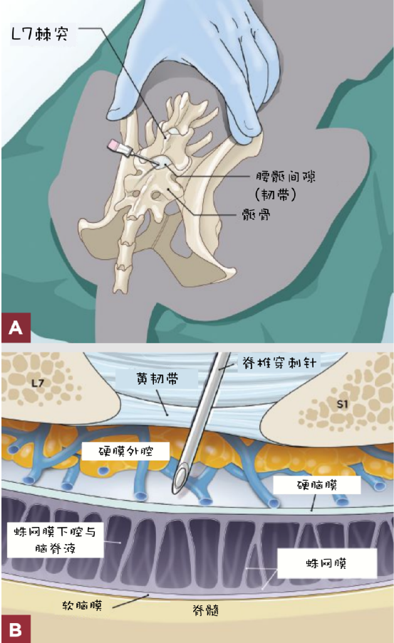 动物怎么麻醉小动物患者局部麻醉_https://www.jmylbn.com_新闻资讯_第7张
